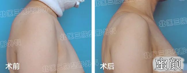 https://img.yiyiaimei.com/mnt/timg/200612/1209433442-0.jpg
