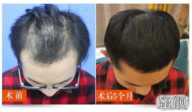 https://img.yiyiaimei.com/mnt/timg/200612/13040SU5-2.jpg