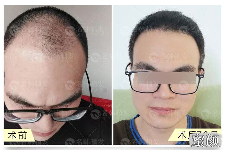 https://img.yiyiaimei.com/mnt/timg/200612/13043B958-12.jpg