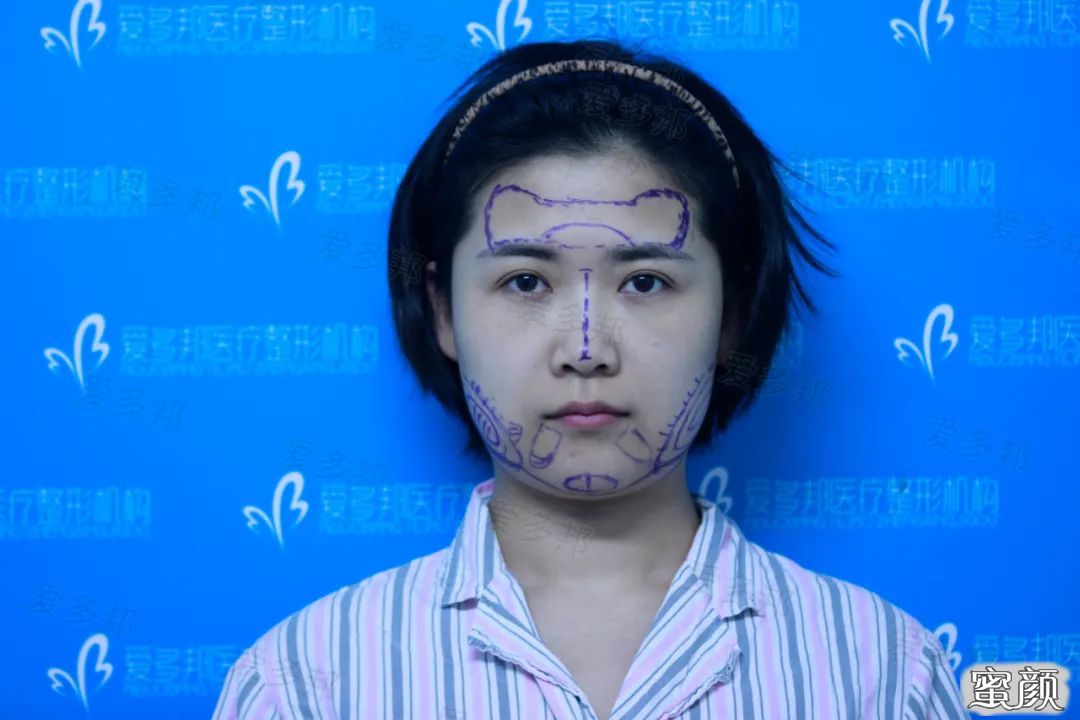 https://img.yiyiaimei.com/mnt/timg/200613/1031161K1-2.jpg