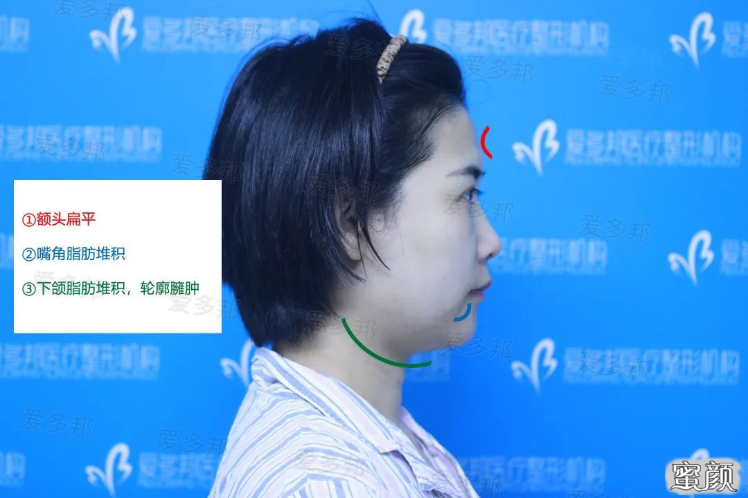https://img.yiyiaimei.com/mnt/timg/200613/1031164504-1.jpg