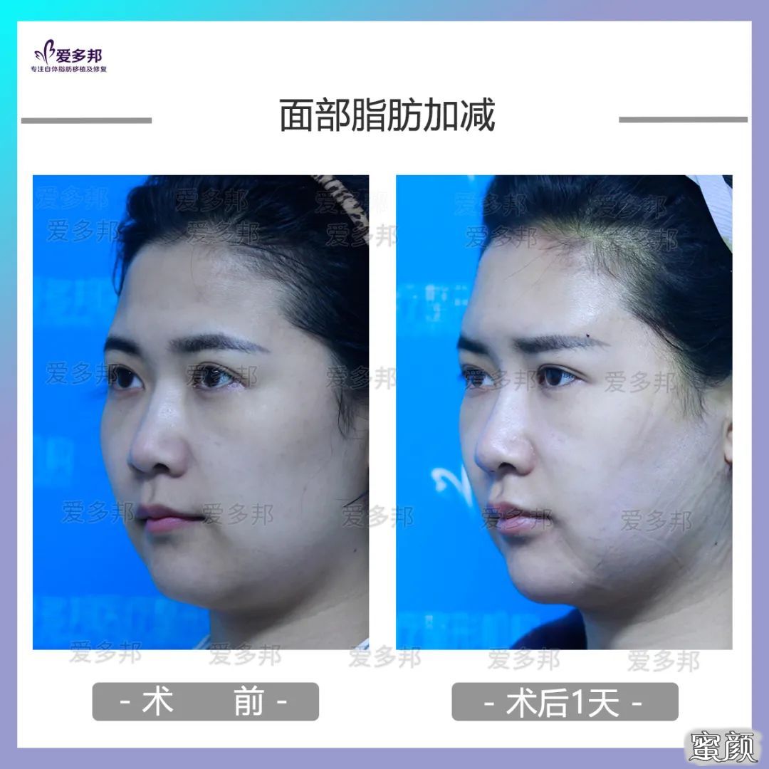 https://img.yiyiaimei.com/mnt/timg/200613/1031193395-5.jpg