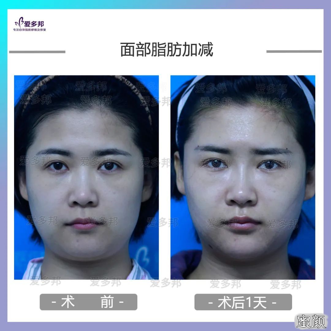 https://img.yiyiaimei.com/mnt/timg/200613/10311S564-4.jpg
