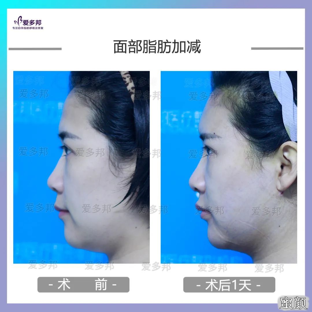 https://img.yiyiaimei.com/mnt/timg/200613/103120A09-6.jpg