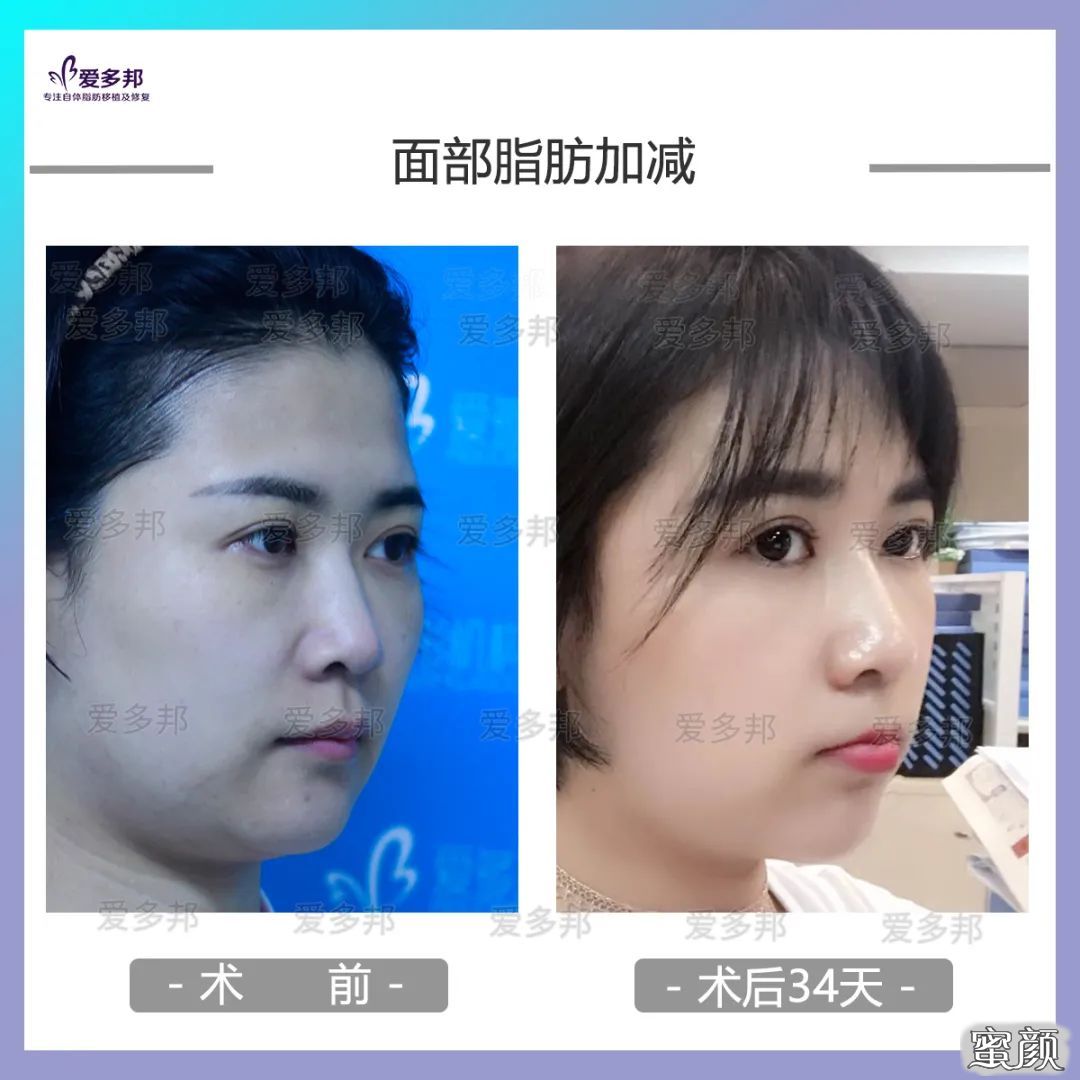 https://img.yiyiaimei.com/mnt/timg/200613/10312225L-8.jpg