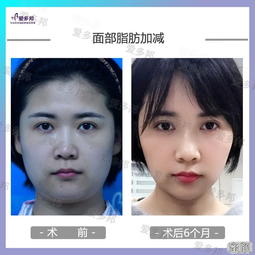 https://img.yiyiaimei.com/mnt/timg/200613/103123D06-9.jpg