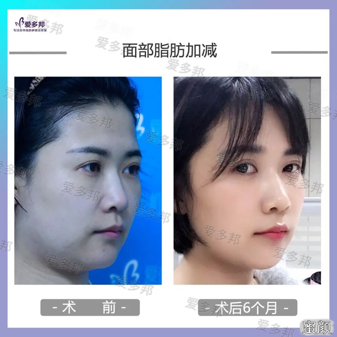 https://img.yiyiaimei.com/mnt/timg/200613/10312445a-10.jpg