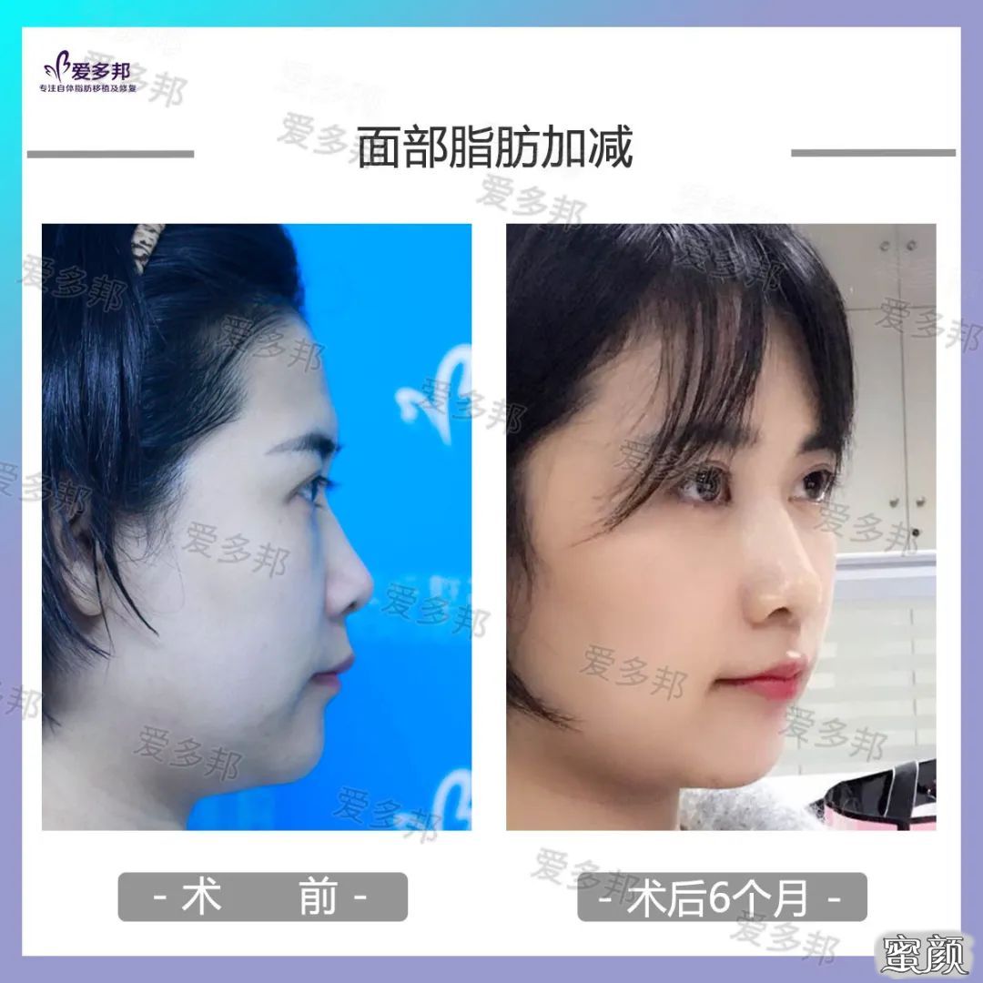 https://img.yiyiaimei.com/mnt/timg/200613/103125E43-11.jpg
