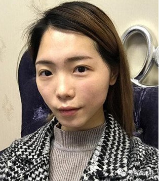 案例图片
