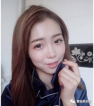 案例图片