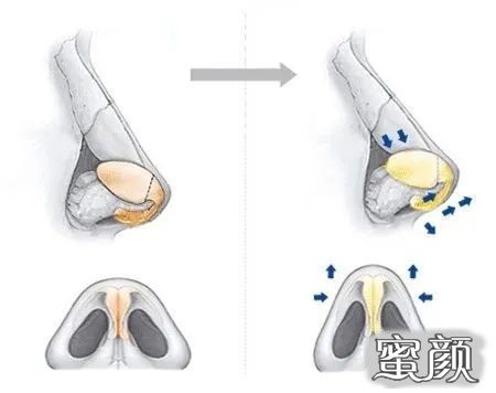 案例图片