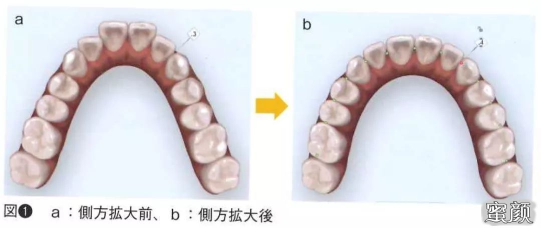 案例图片