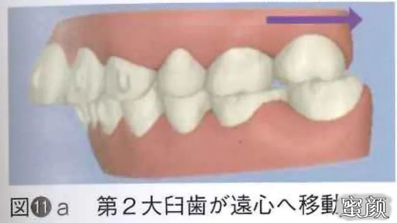 案例图片