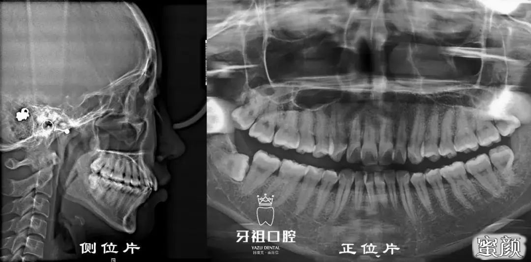 案例图片