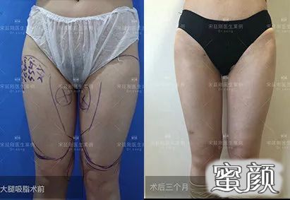 案例图片