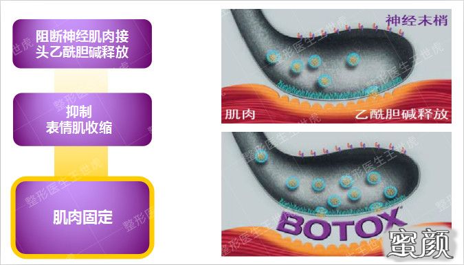 https://img.yiyiaimei.com/mnt/timg/200614/11243Ia0-0.jpg 案例图片