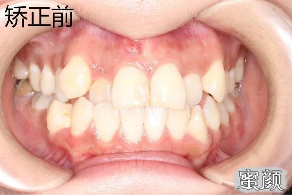 https://img.yiyiaimei.com/mnt/timg/200614/11312134Y-0.jpg