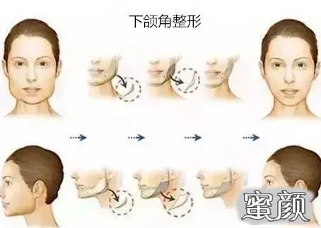 https://img.yiyiaimei.com/mnt/timg/200614/123321D53-1.jpg