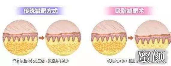 https://img.yiyiaimei.com/mnt/timg/200615/120510H59-3.jpg 案例图片