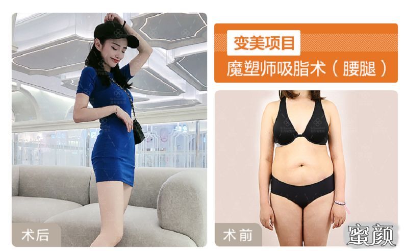案例图片