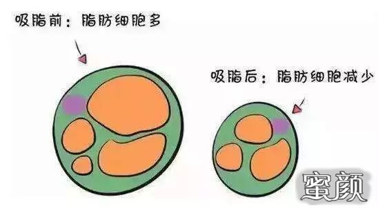 https://img.yiyiaimei.com/mnt/timg/200615/12051S322-5.jpg 案例图片