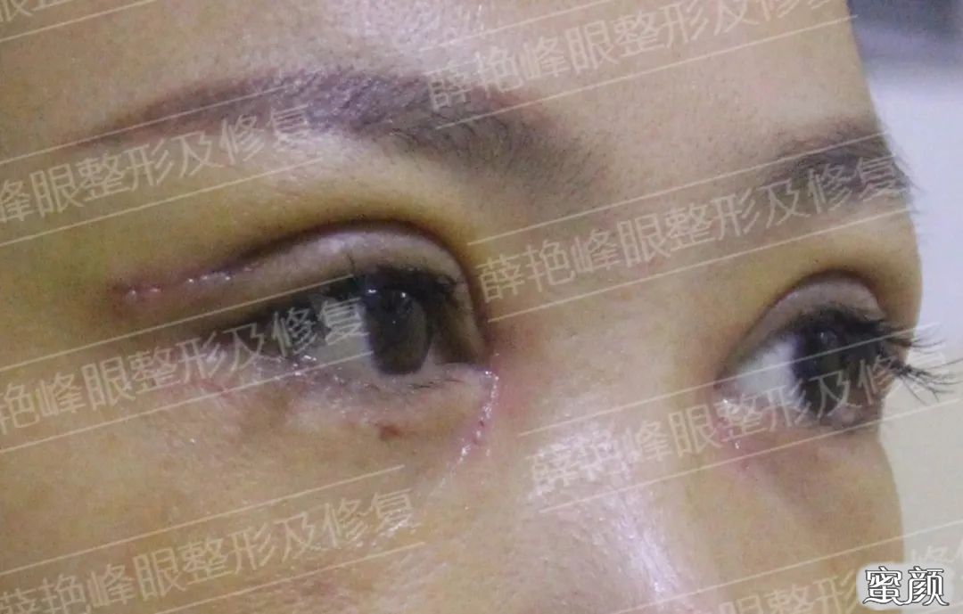 案例图片