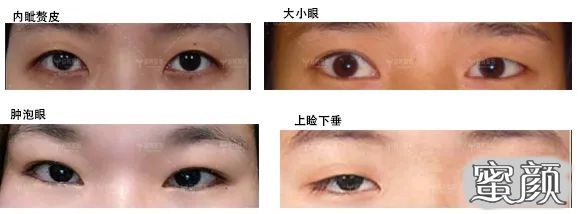 案例图片