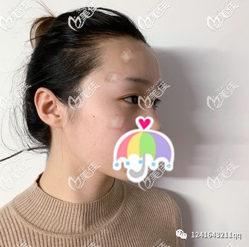 案例图片