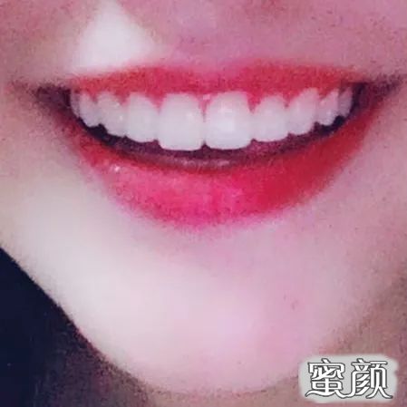 案例图片
