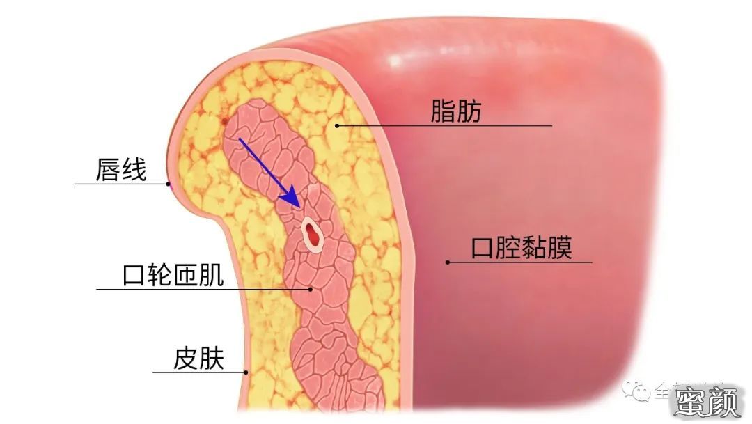 案例图片