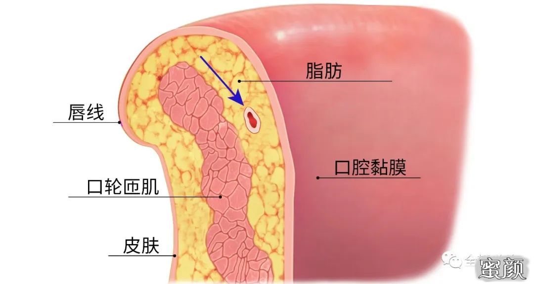 案例图片