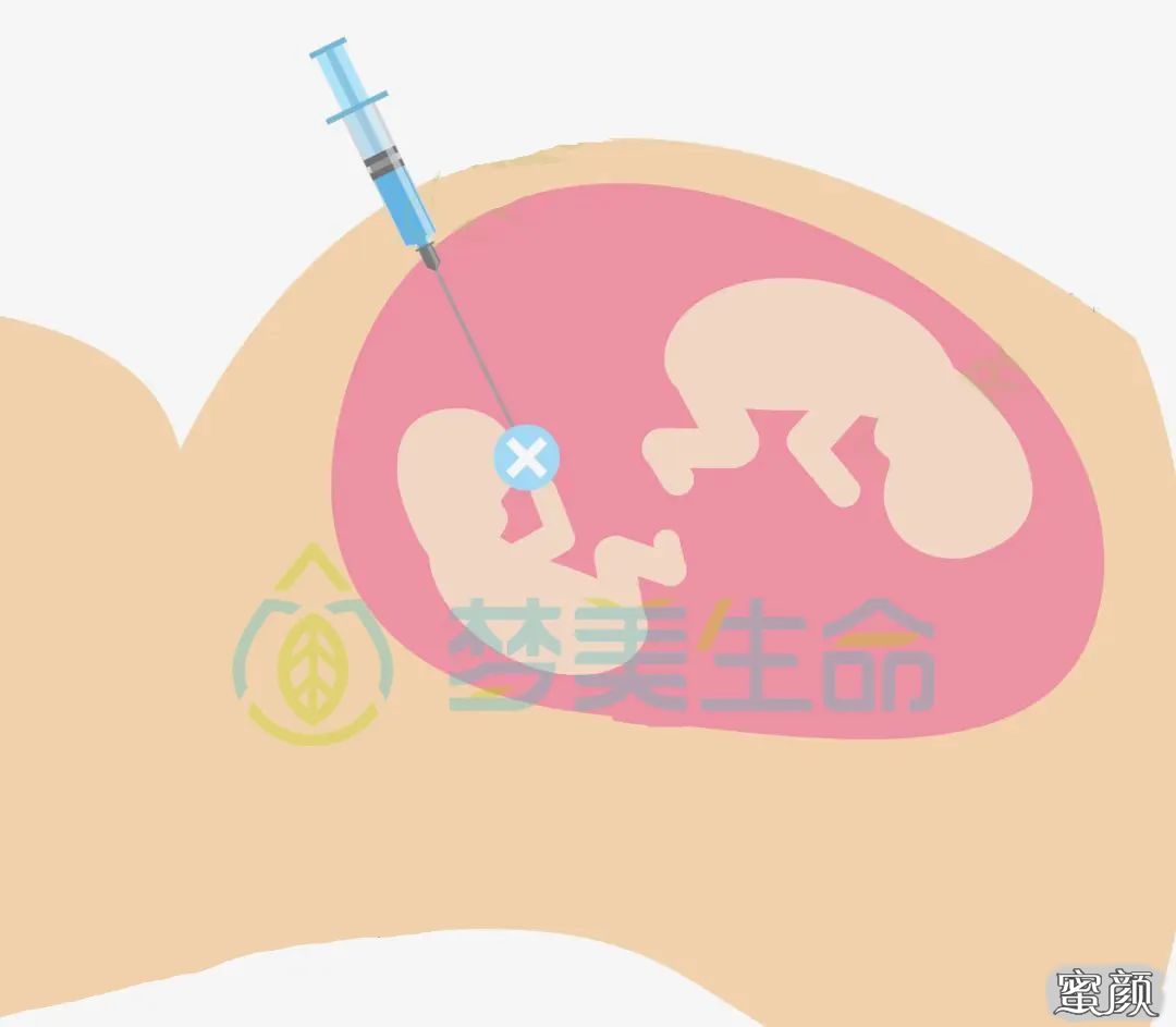 https://img.yiyiaimei.com/mnt/timg/200618/1200545405-3.jpg 案例图片