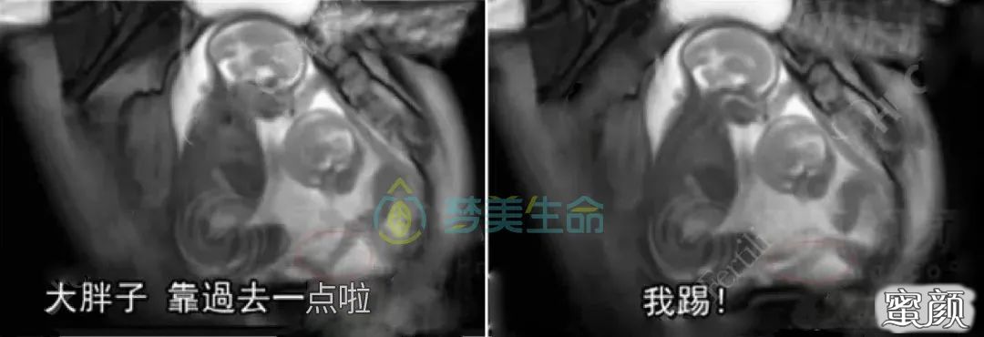 https://img.yiyiaimei.com/mnt/timg/200618/1200595225-8.jpg 案例图片