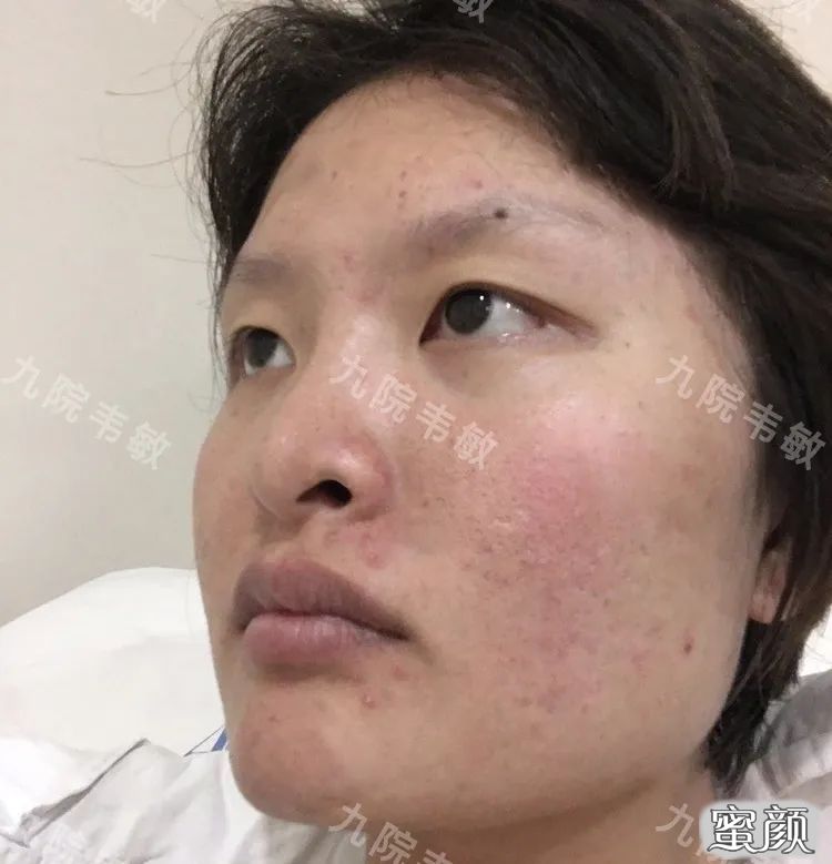 https://img.yiyiaimei.com/mnt/timg/200618/121443O33-1.jpg