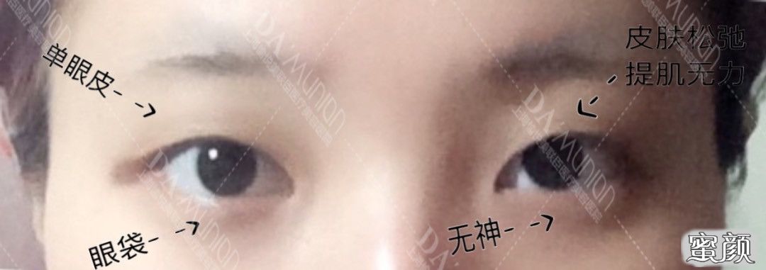 https://img.yiyiaimei.com/mnt/timg/200618/13044024A-1.jpg