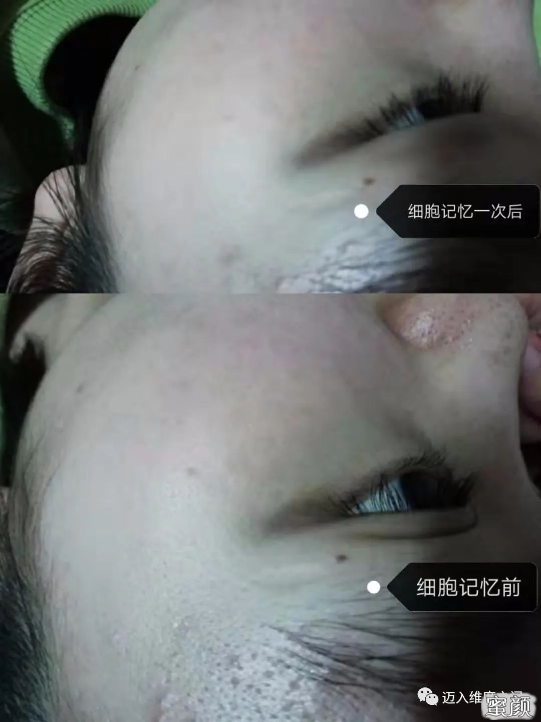 案例图片