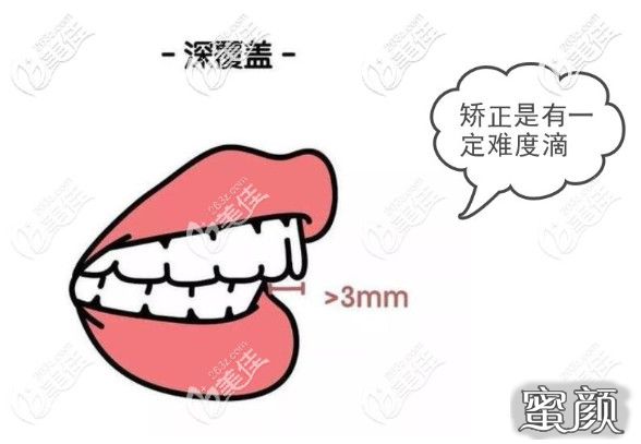 案例图片