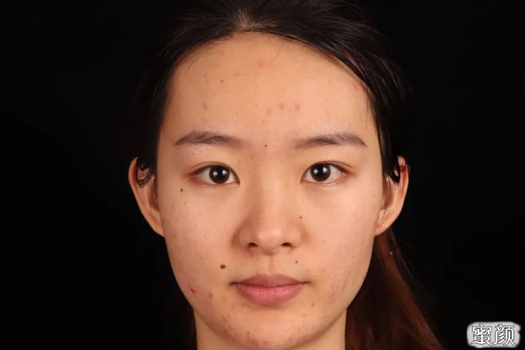 https://img.yiyiaimei.com/mnt/timg/200619/1124255353-0.jpg