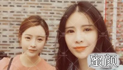 https://img.yiyiaimei.com/mnt/timg/200619/140414M32-0.jpg