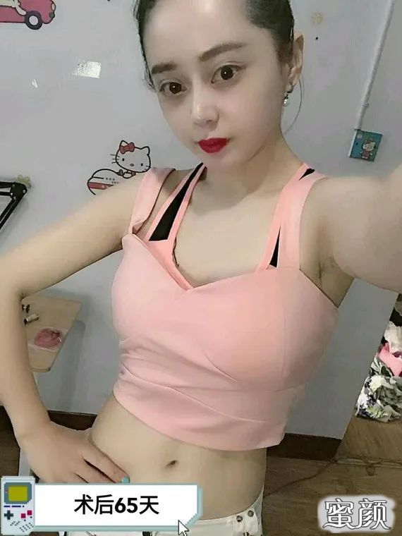 案例图片