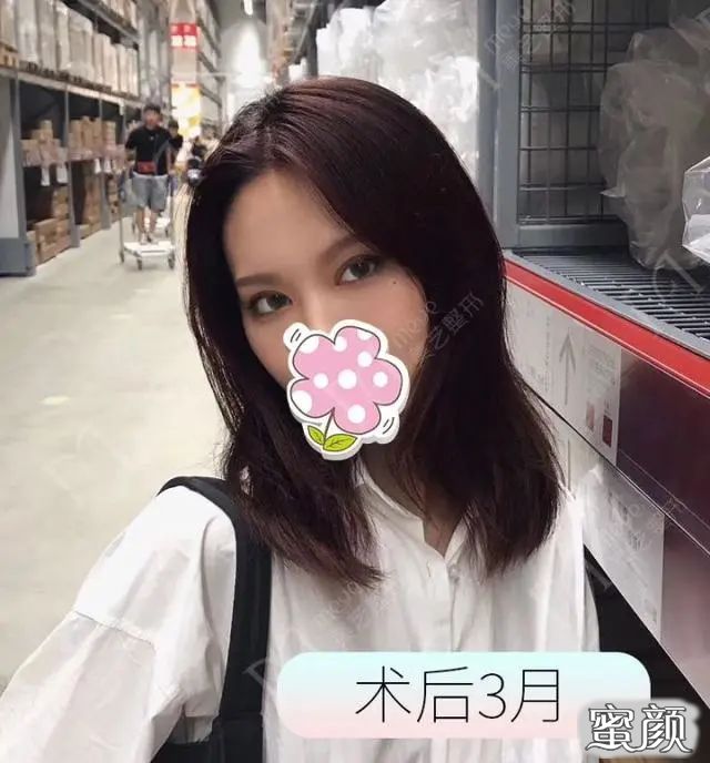 案例图片