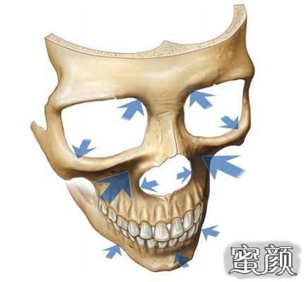 https://img.yiyiaimei.com/mnt/timg/200620/124U91429-5.jpg