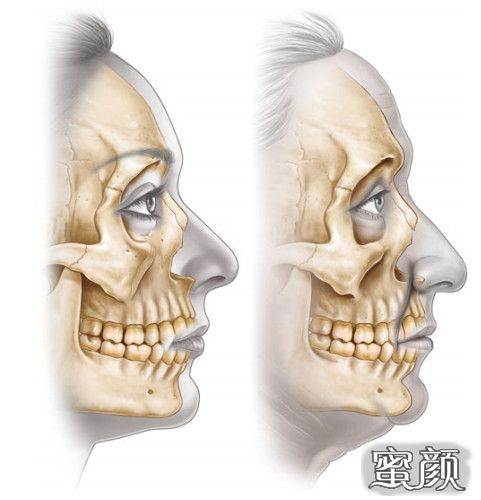 https://img.yiyiaimei.com/mnt/timg/200620/124UW925-4.jpg