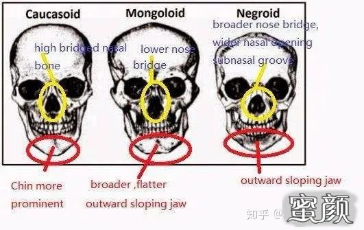 案例图片