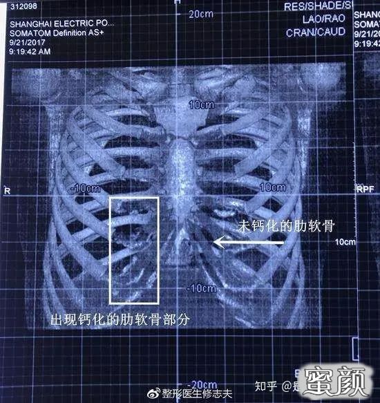 案例图片