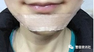 案例图片