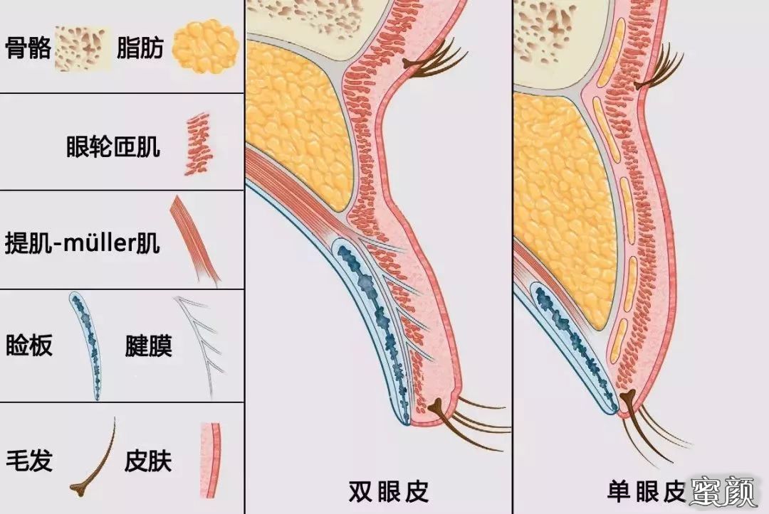 案例图片