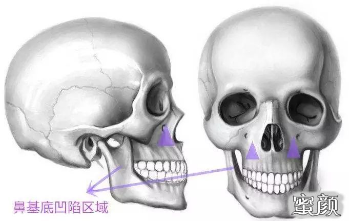 案例图片