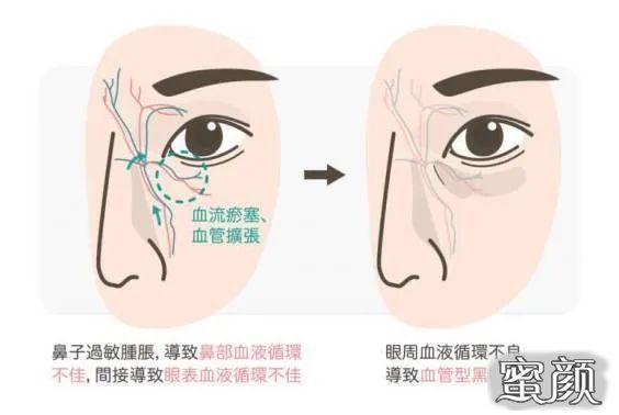 案例图片