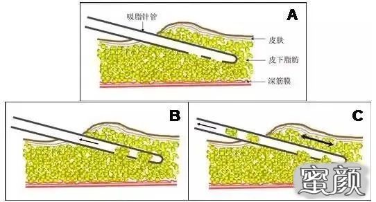 案例图片